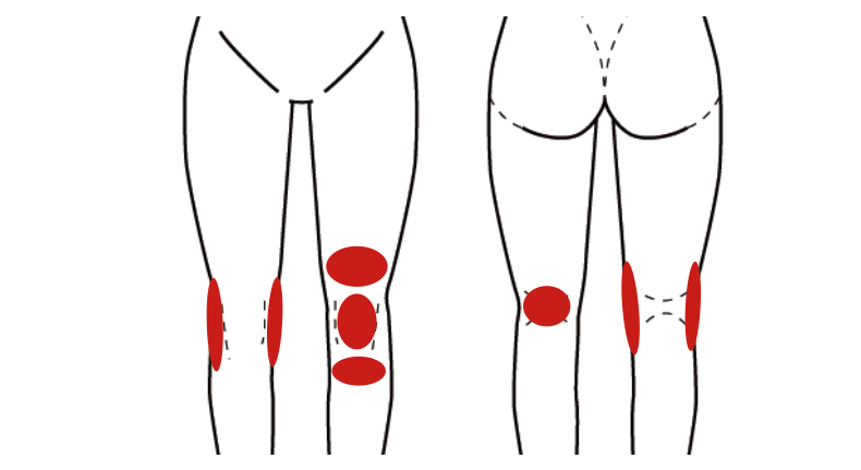 膝痛の特徴